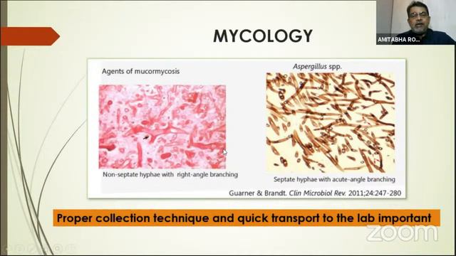 Mucormycosis: An emerging problem in the horizon смотреть онлайн