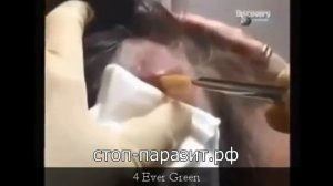 Страшный подкожный паразит пожирает плоть. Манговый червь.