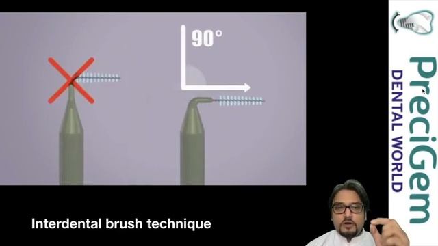 How to clean Full Mouth Dental Implants? | best dental implant surgeon explains || Dr Mayur Khairna смотреть онлайн