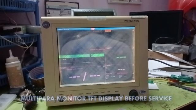 #11 RMS MULTIPARA MONITOR TFT DISPLAY REPAIR смотреть онлайн