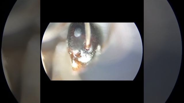 Муравей под микроскопом! #youtubevideo #microscope