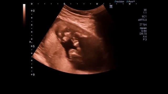 эта МАМОЧКА родила деток, КОТОРЫЕ рождаются раз в 480 ЛЕТ… смотреть онлайн