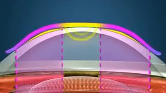 Как работают ночные линзы ок линзы? смотреть онлайн
