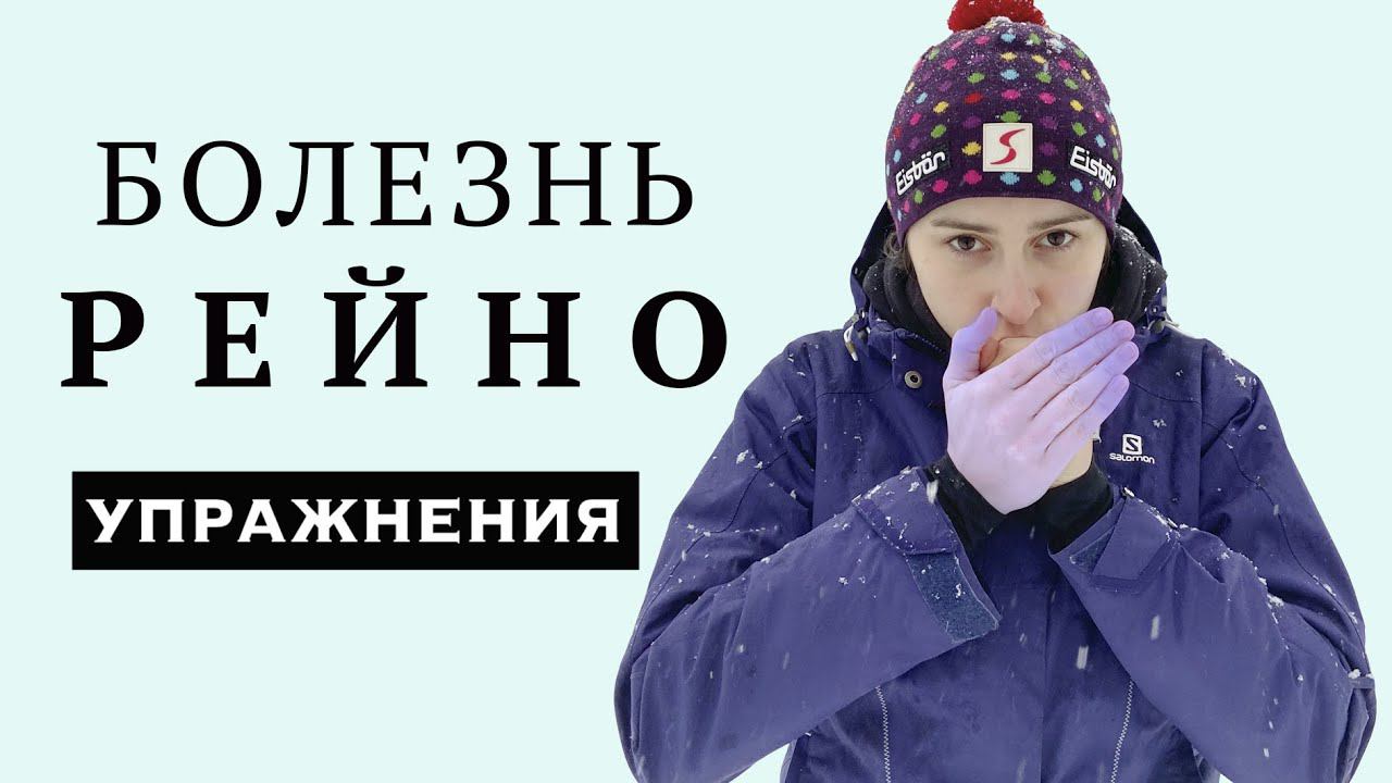 МЕРЗНУТ РУКИ / СИНДРОМ БОЛЕЗНЬ РЕЙНО / ЛФК УПРАЖНЕНИЯ ДЛЯ ПАЛЬЦЕВ РУК смотреть онлайн