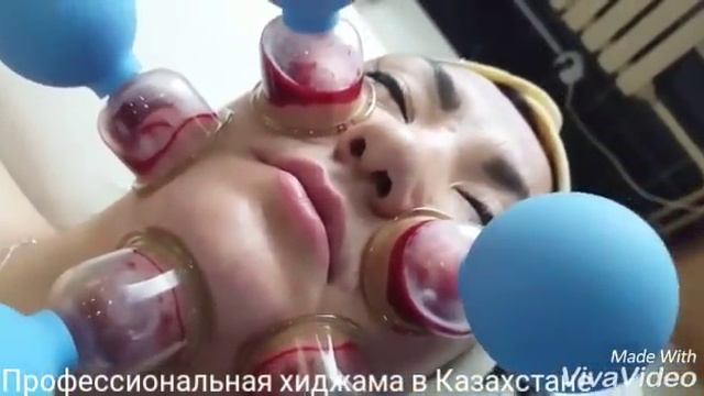 Капилляротерапия (Хиджама/Обучение) для омоложения лица без хирургии смотреть онлайн