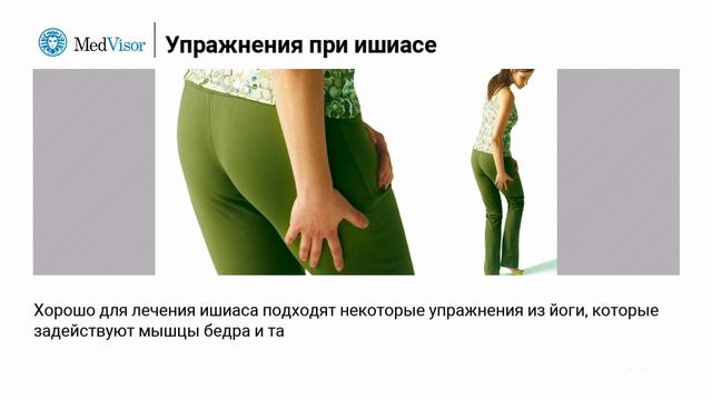 Упражнения при ишиасе седалищного нерва. 6 верных способов справиться с болью смотреть онлайн