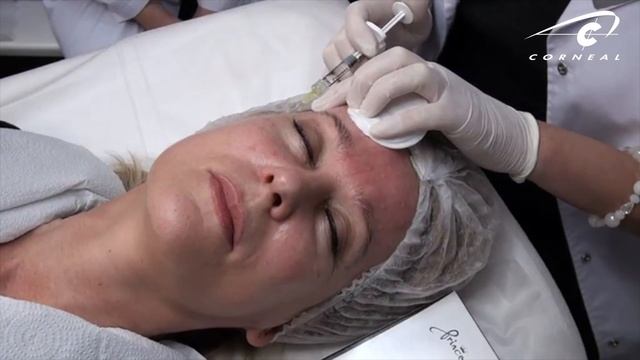 Папулы видны, если техника правильная смотреть онлайн