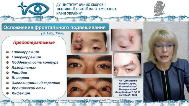 Осложнения хирургии блефароптоза, докладчик Тронина С.А. смотреть онлайн