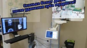 Сколько болит десна после удаления зуба мудрости?