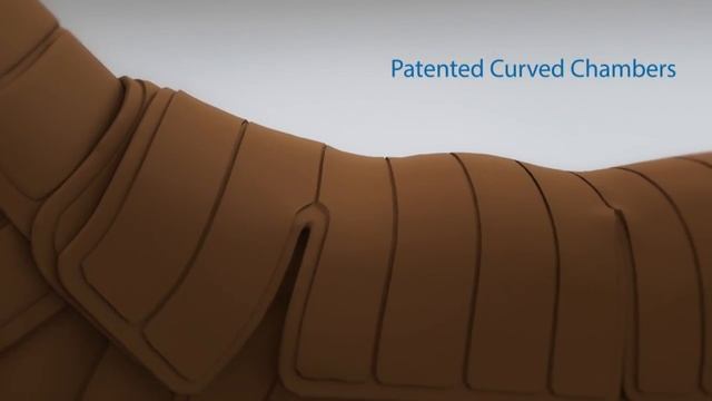 Treating Lymphedema - The Flexitouch System Lymphedema Pump смотреть онлайн