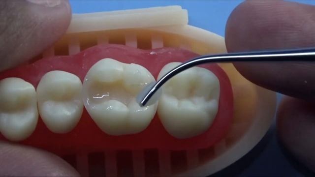 Practice Class II Composite Restoration | General Dentist Griya RR смотреть онлайн