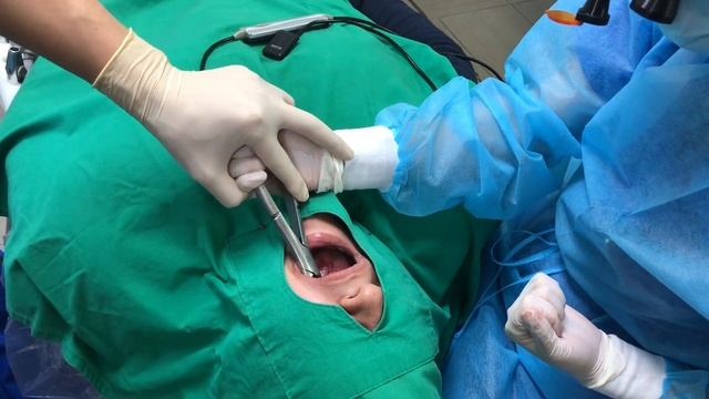 How to teach to extract the upper wisdom tooth with forceps смотреть онлайн