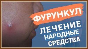 ЛЕЧЕНИЕ ФУРУНКУЛА НАРОДНЫМИ СРЕДСТВАМИ