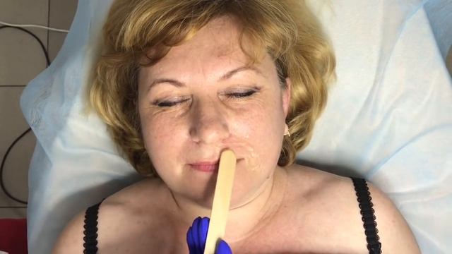 Удаляю усики в ЛазерХауз. Лазерная эпиляция. Удаление нежелательных волос на лице и теле навсегда смотреть онлайн