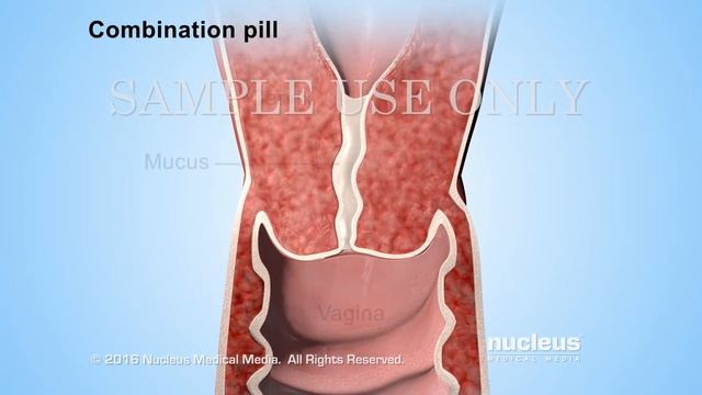 Birth Control Pills смотреть онлайн