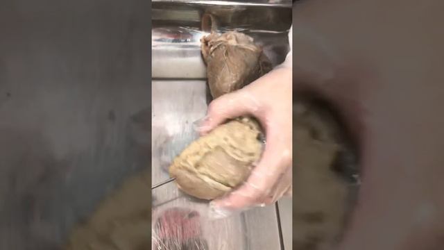 Arterias coronarias смотреть онлайн