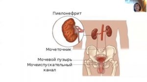Заболевания выделительной системы