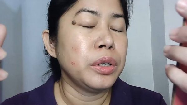 Beauty Mole Removal Sweep Spot Pen | Removal Of Warts, Moles, Etc. | Effective Skin Tag Remover!