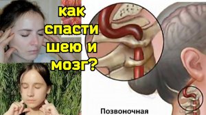 Спазм мышц шеи угрожает сосудам мозга. Как зеванием разблокировать 4 главные суда шеи?