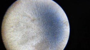 Сопли простуженного человека,под микроскопом 1280x