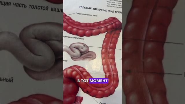 Запоры, Причины, Последствия и Устранение! Часть 19❤️❤️❤️ смотреть онлайн