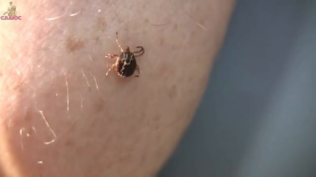 3 быстрых способа безопасно достать клеща смотреть онлайн