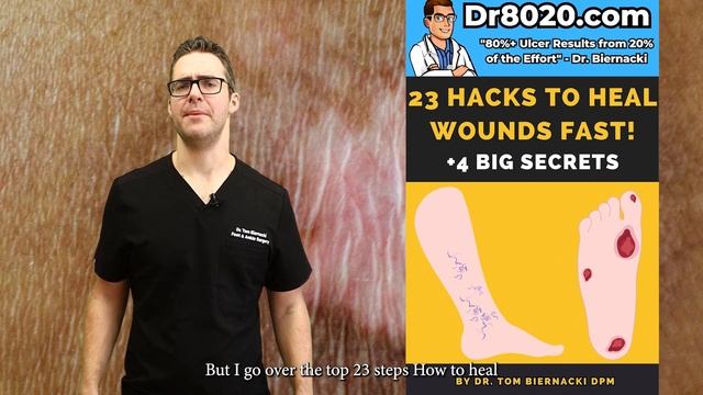 15 Most Common Skin Conditions Found On The Feet [& How To Fix Them] смотреть онлайн