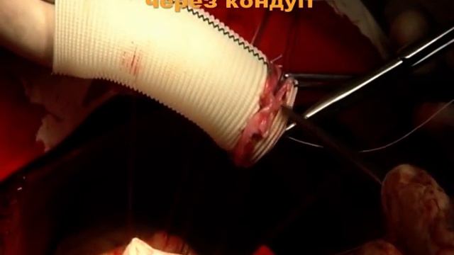 Каброль для ІН.mpg смотреть онлайн