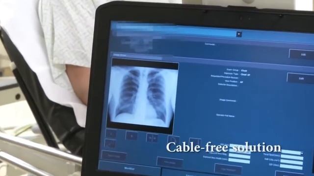 Рентгеновская DR-панель AGFA DX-D 40G