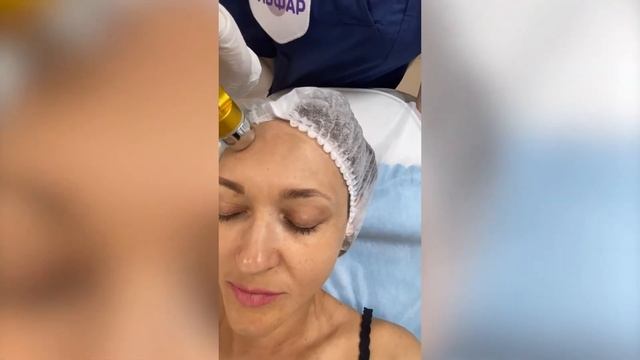 БЕЗЪИНЕКЦИОННАЯ МЕЗОТЕРАПИЯ смотреть онлайн