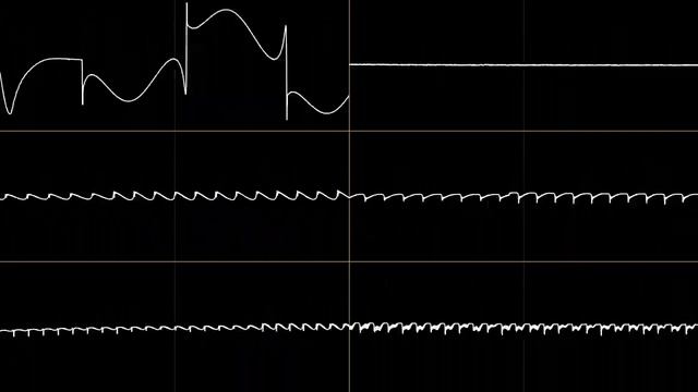 "WORLD INCINERATOR" (VRC7) [Oscilloscope View] смотреть онлайн