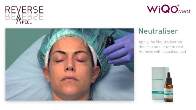 REVERSE PEEL смотреть онлайн