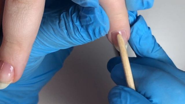 Генетическая болезнь ногтей? Исправление формы ногтей смотреть онлайн