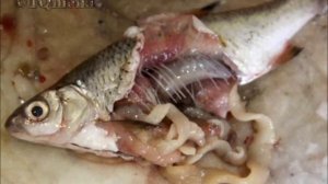 Паразиты фото, как выглядят разные паразиты человека, мотивирует :)