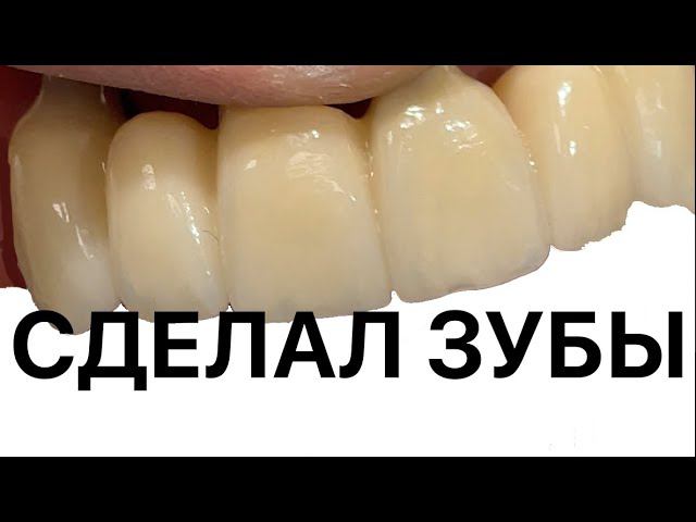ZrO2 Ceramic Сделал зубы, видео процесса. Made Teeth
