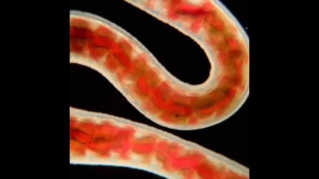 ПОД МИКРОСКОПОМ / ТИХОХОДКА И ДРУГИЕ МИКРООРГАНИЗМЫ