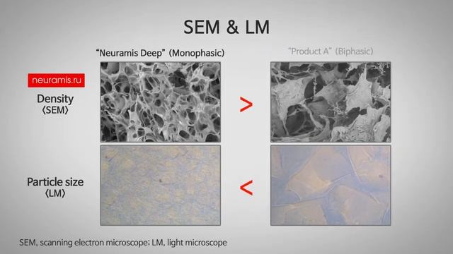 Наблюдение частиц гиалуроновой кислоты в геле Нейрамис | Neuramis | particle observation смотреть онлайн