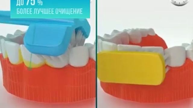 Лучшая зубная щетка в мире смотреть онлайн