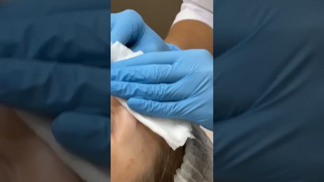 Фотоомоложения и фотолечения кожи смотреть онлайн