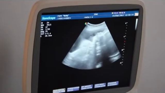 Перинатальный центр смотреть онлайн