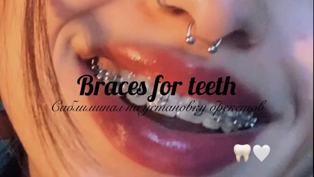 УСТАНОВИТЬ БРЕКЕТЫ? саблиминал // by swezer смотреть онлайн