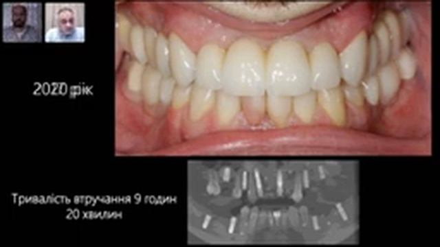 Медикаментозна седація дорослих в стоматології | В. Пайкуш і А. Гук