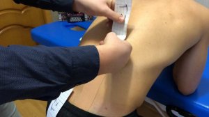 Наложение кинезио тейпа с целью стабилизации поясницы