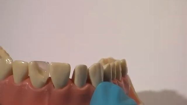 Эстетика и функция Композиты для зубов Ю.Манхарт Диск 3