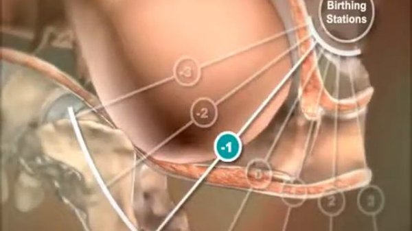 Биомеханизм родов в 3D