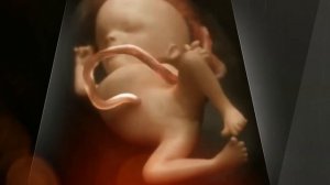 КУДА КАКАЕТ РЕБЕНОК в УТРОБЕ?!