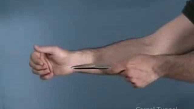 Carpal Tunnel Syndrome смотреть онлайн