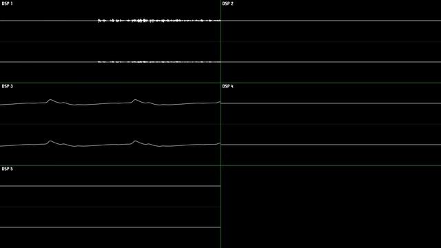 Kirby Super Star - Gourmet Race [Oscilloscope Deconstruction] смотреть онлайн