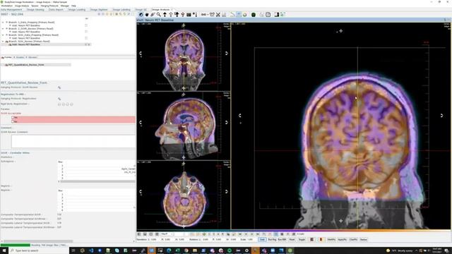TWIML Kaggle Meetup Summer 2020 - 07/31/2020 смотреть онлайн