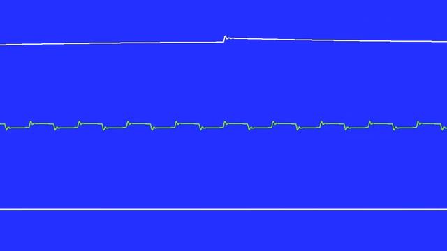 COMMODORE C64 SID - SYS64738 DAYS - LINUS - 2018 - X18 (Oscilloscope View) смотреть онлайн